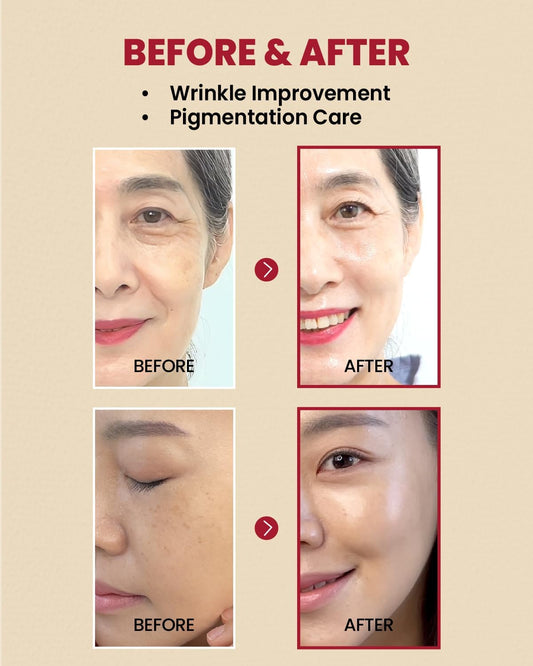 SEOUL 1988 Serum: Retinal Liposome 2% + Black Ginseng - 30ml-K-SECRET-Noura Skincare