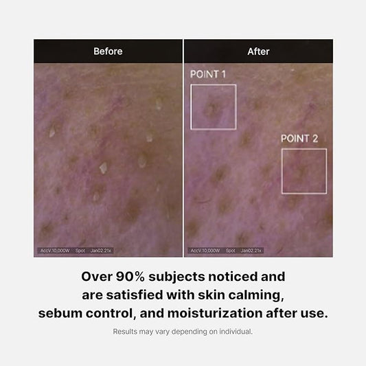 Red Foam Cleanser - 120ml-Medicube-Noura Skincare