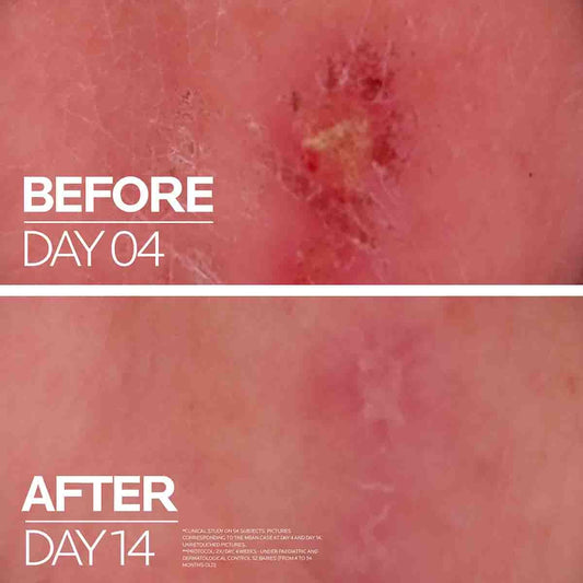 Cicaplast Balm B5 Multi-Purpose Repairing Balm - 40ml-La Roche-Posay-Noura Skincare