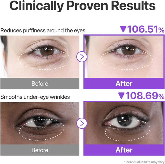 NAD+ Collagen Under Eye Patches