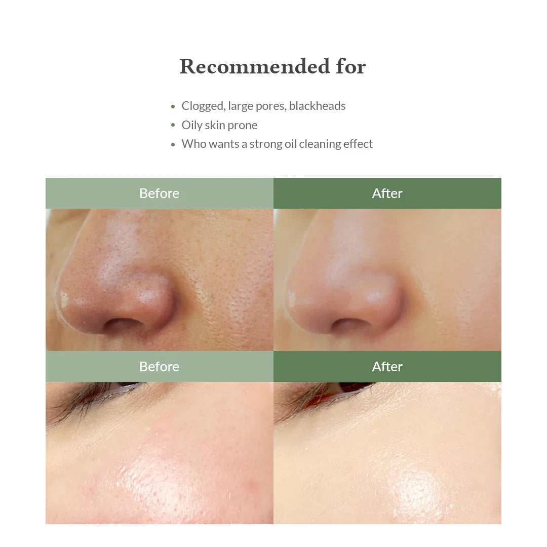 Premium Quick Step Sebum Cleanser - 100ml-Dr.Althea-Noura Skincare