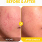 Pure Vitamin C 24% Serum - 30ml-TIRTIR-Noura Skincare
