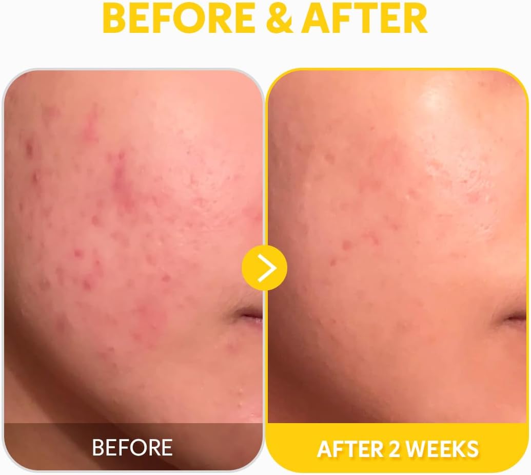 Pure Vitamin C 24% Serum - 30ml-TIRTIR-Noura Skincare