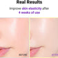 Hyper Retinol EX 1.0 Serum - 20ml-Isntree-Noura Skincare