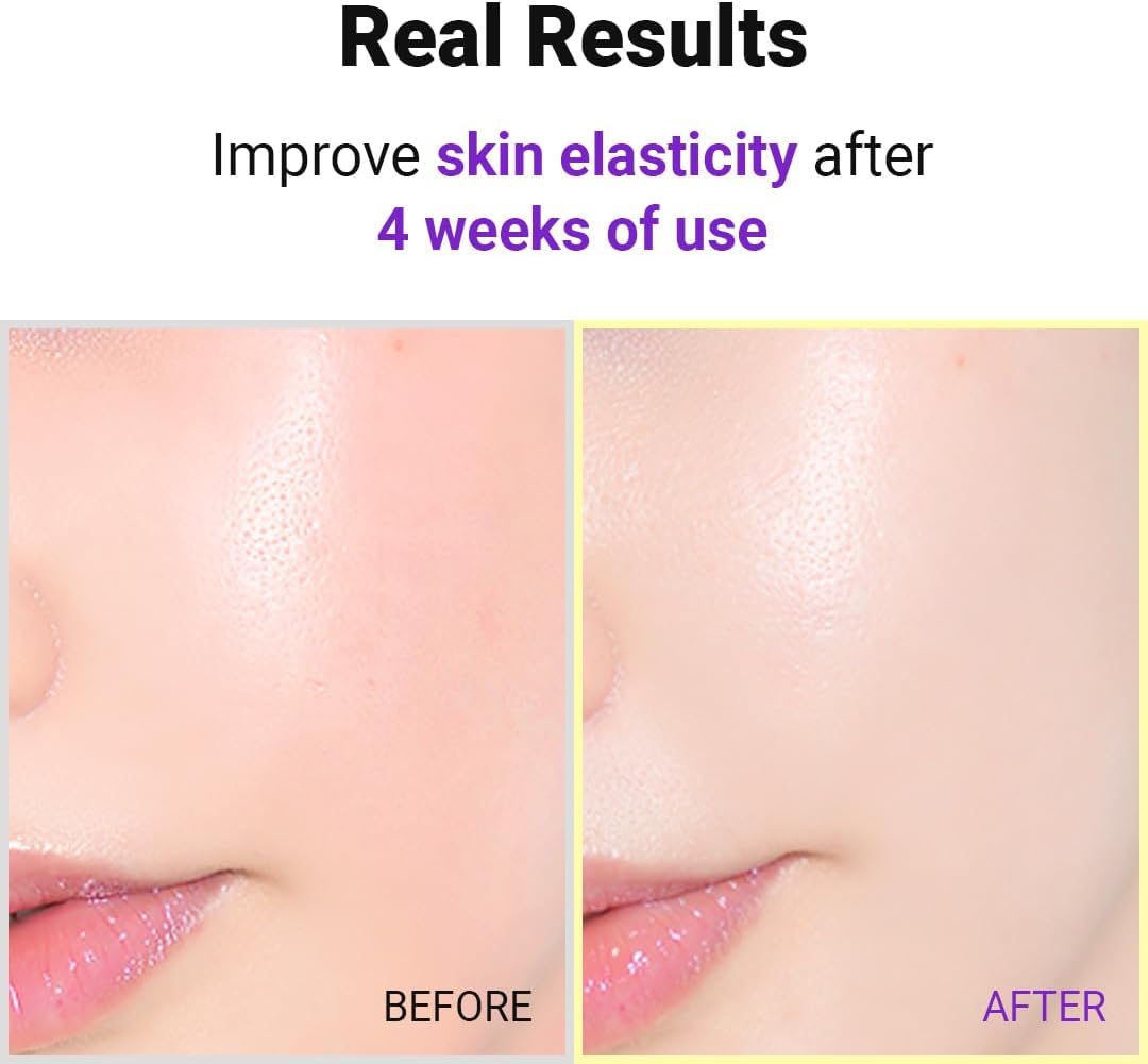 Hyper Retinol EX 1.0 Serum - 20ml-Isntree-Noura Skincare