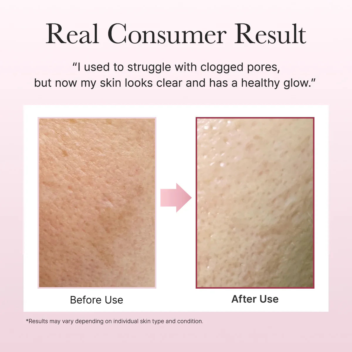 Fresh Rosehip Mochi Cleanser - 120g