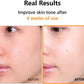 Hyper Vitamin C 23 Serum - 20ml-Isntree-Noura Skincare