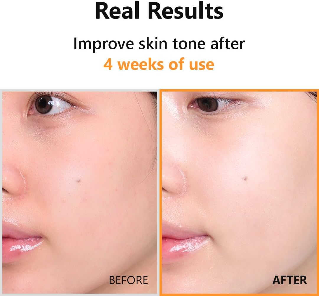 Hyper Vitamin C 23 Serum - 20ml-Isntree-Noura Skincare