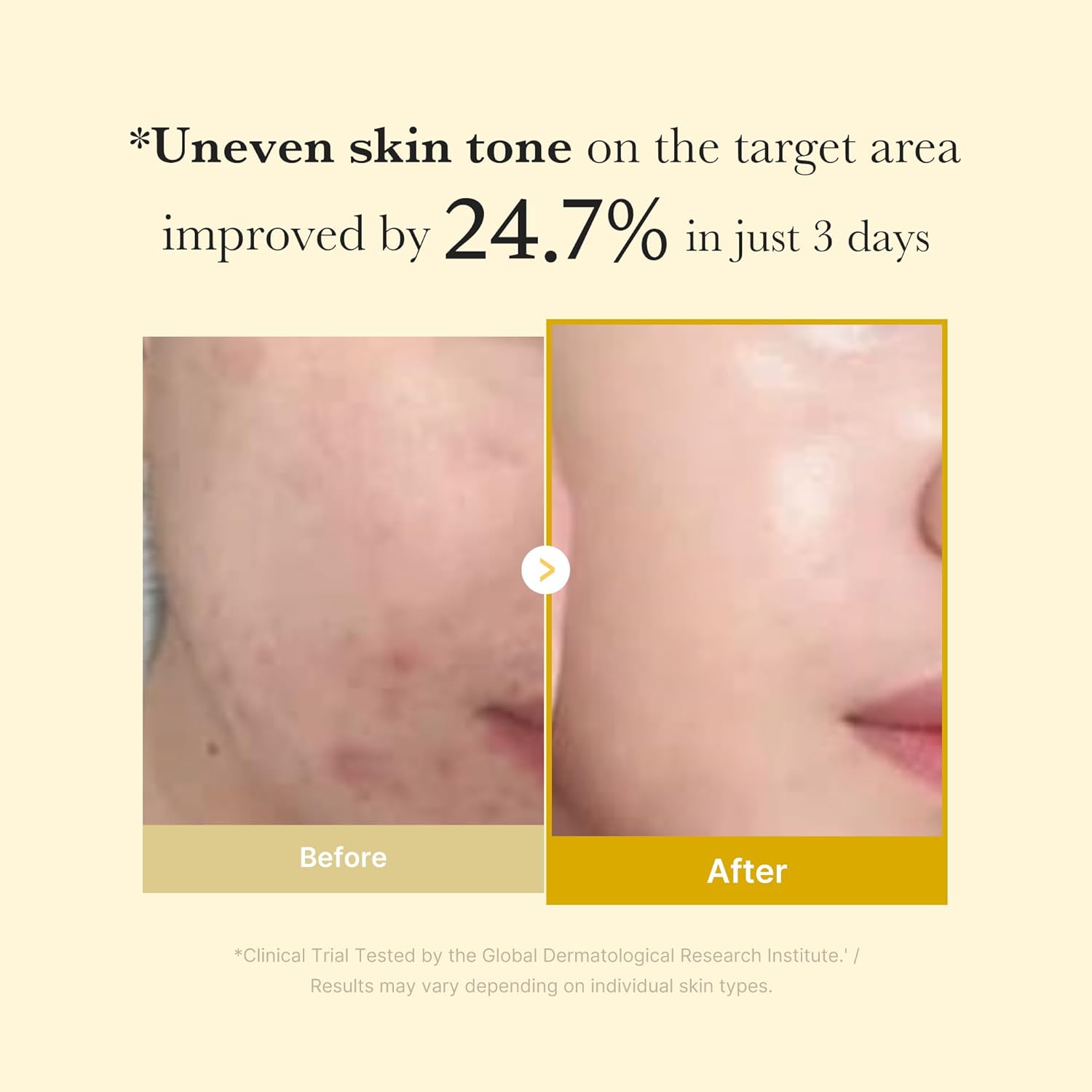 Kojic Acid Turmeric Night Wrapping Mask - 75ml-Medicube-Noura Skincare