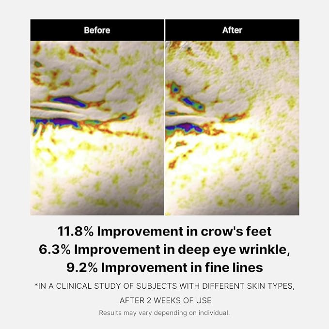 Deep Lifting Peptide Eye Cream - 30ml-Medicube-Noura Skincare