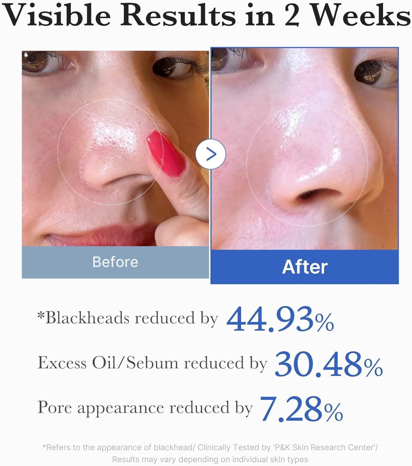 Zero Pore Pad 2.0 - 155g