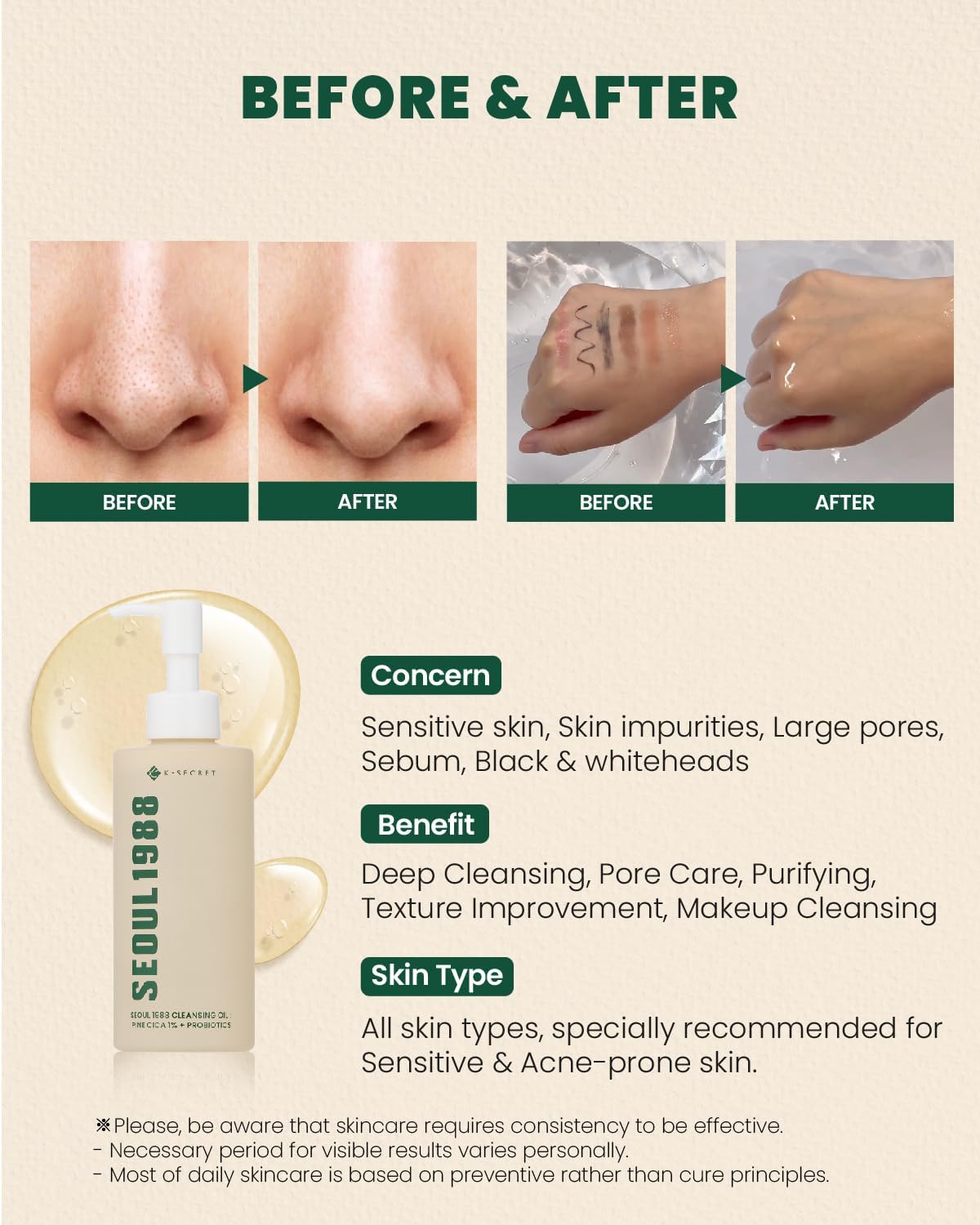 SEOUL 1988 Cleansing Oil: Pine Cica 1% + Probiotics-K-SECRET-Noura Skincare