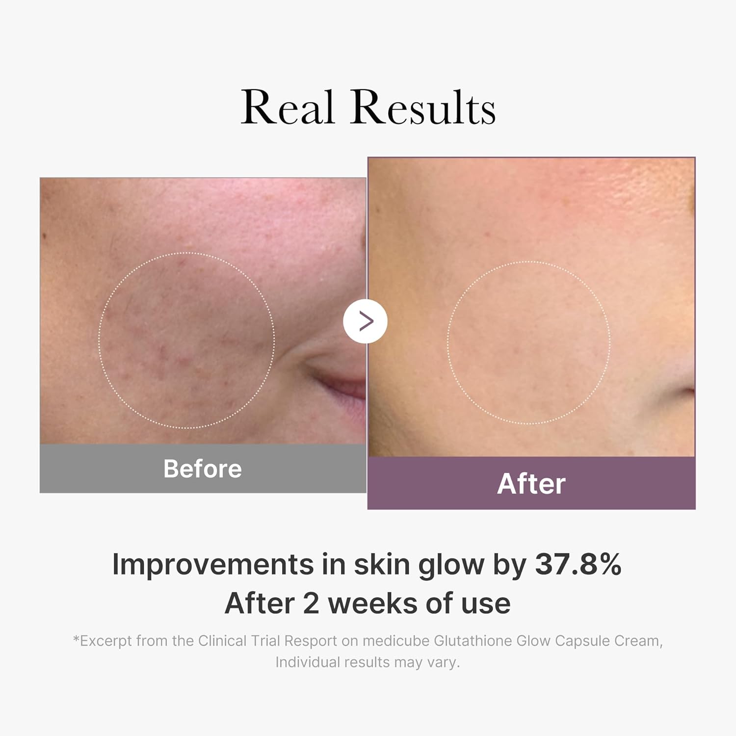 AGE-R Glutathione Glow Capsule Cream - 50ml-Medicube-Noura Skincare