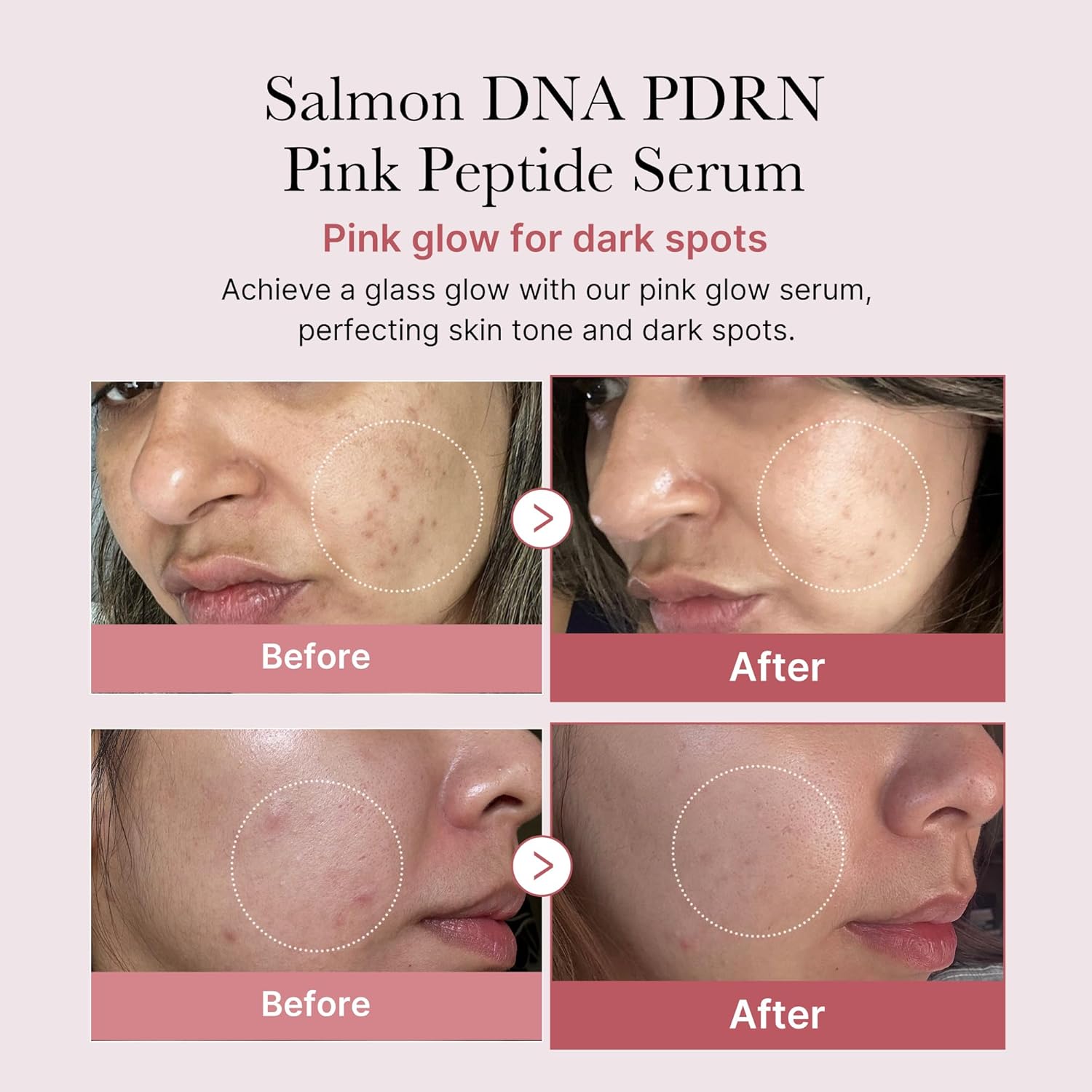 PDRN Pink Peptide Serum - 30ml-Medicube-Noura Skincare