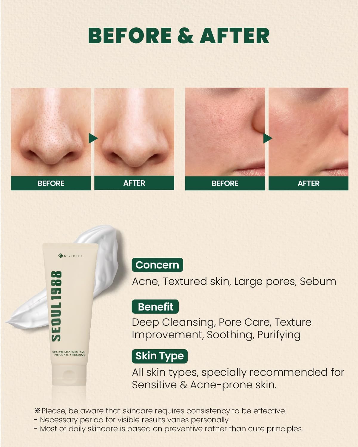 SEOUL 1998 Cleansing Foam: Pine Cica 1%+ Probiotics - 150ml-K-SECRET-Noura Skincare