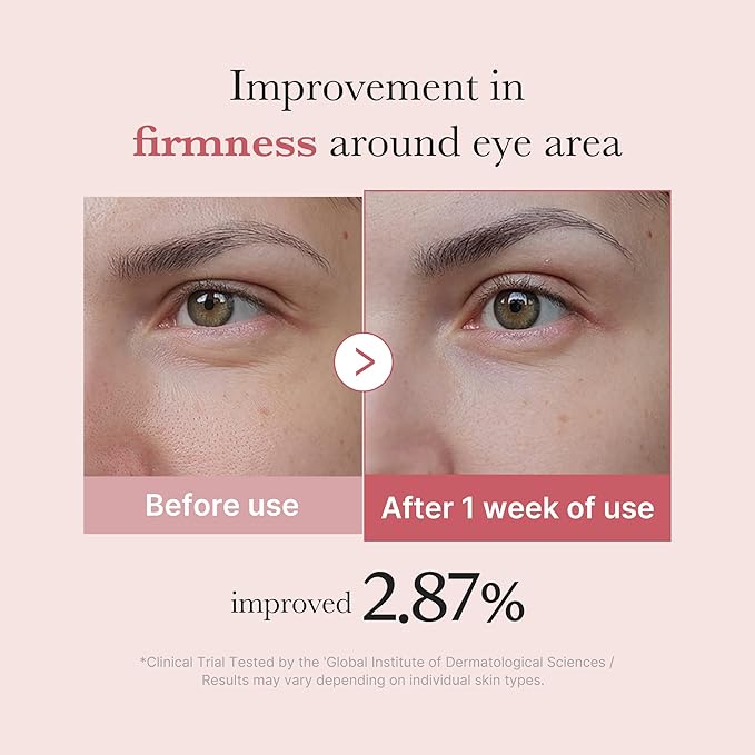 PDRN Pink Peptide Eye Cream - 30ml-Medicube-Noura Skincare