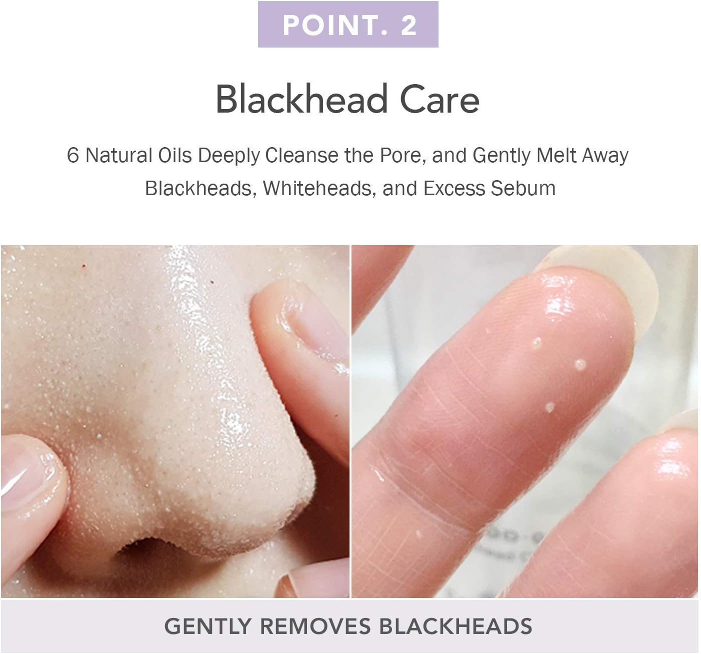 Derma Nature Fresh Blackhead Jojoba Cleansing Oil - 150ml-Celimax-Noura Skincare