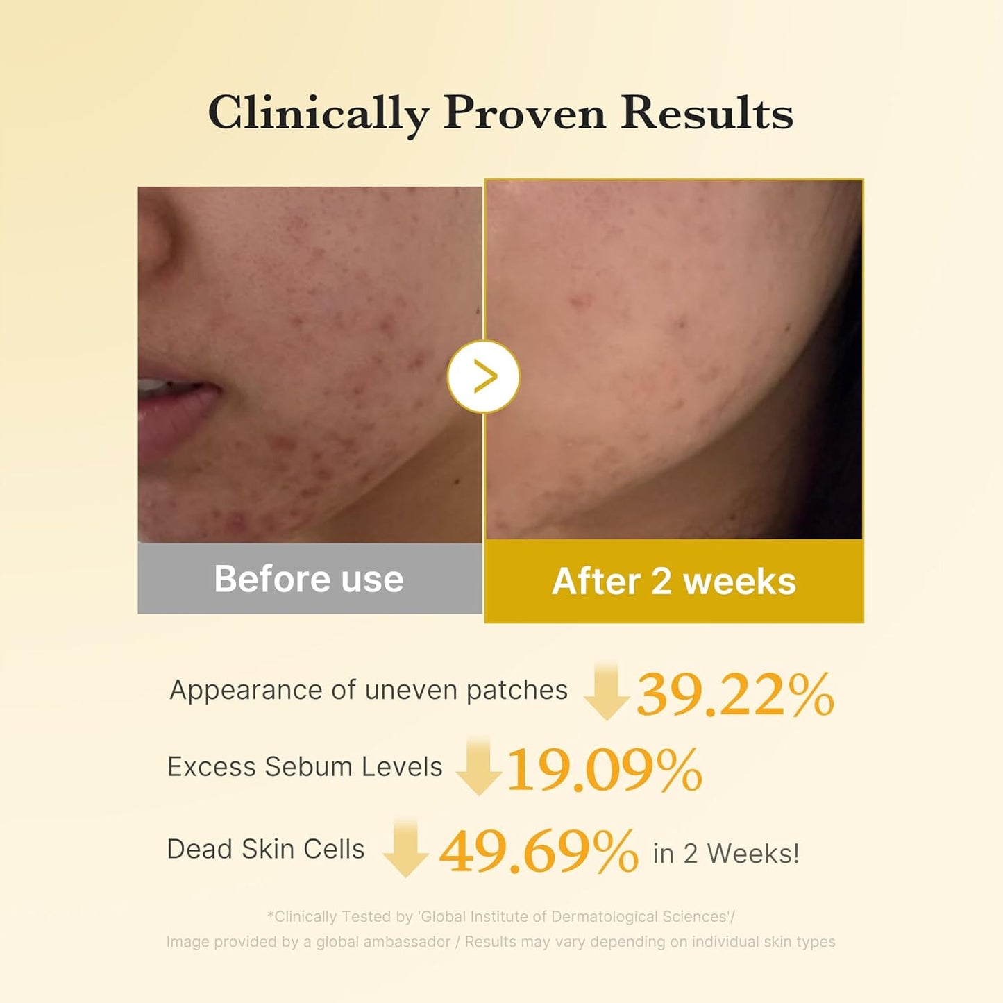 Kojic Acid Turmeric Resurfacing Toner - 160ml-Medicube-Noura Skincare
