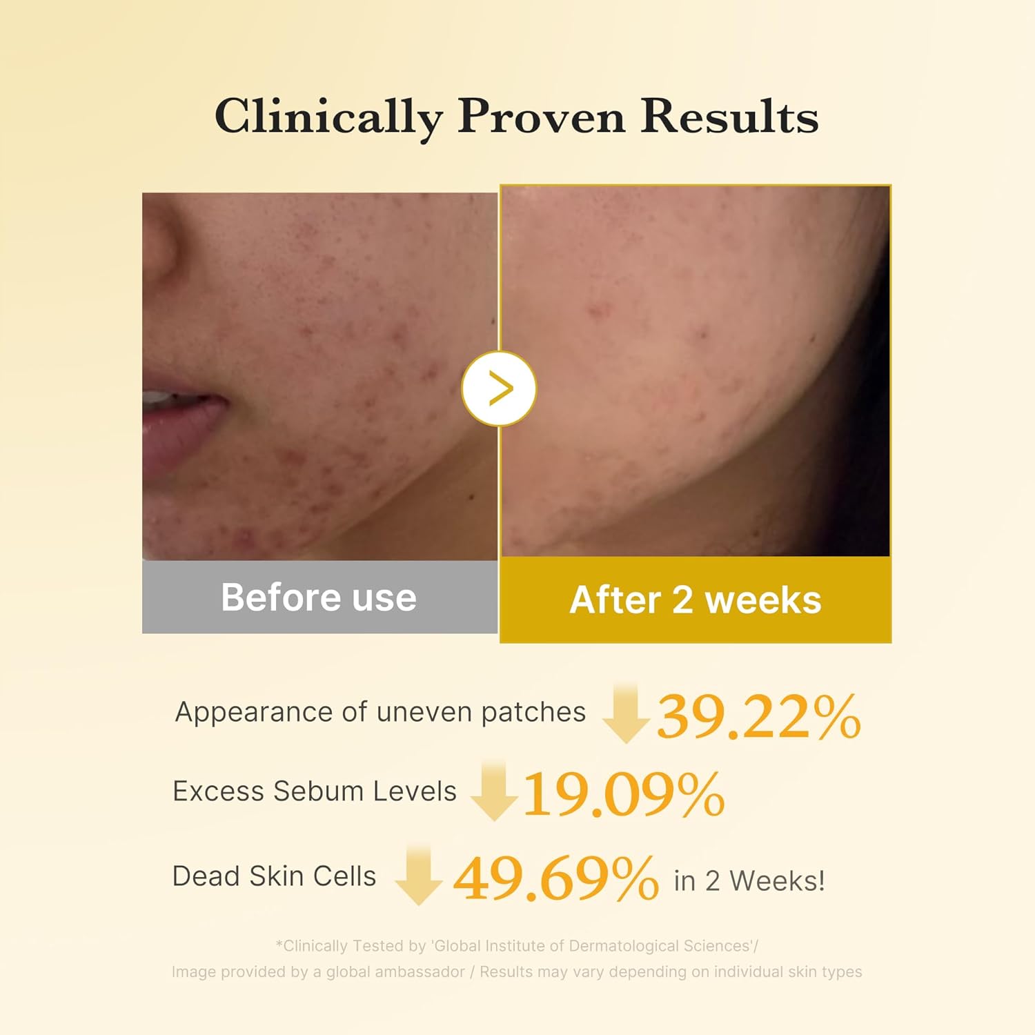 Kojic Acid Turmeric Resurfacing Toner - 160ml-Medicube-Noura Skincare