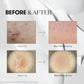 Reedle Shot 100 - 50ml-VT Cosmetics-Noura Skincare