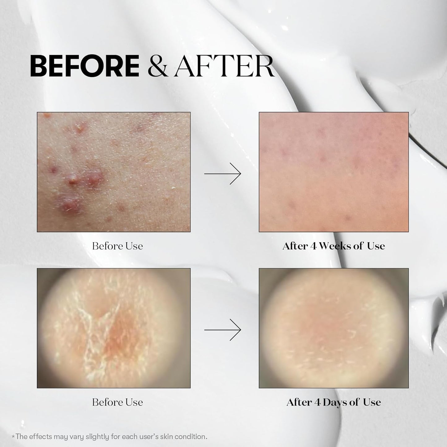 Reedle Shot 100 - 50ml-VT Cosmetics-Noura Skincare