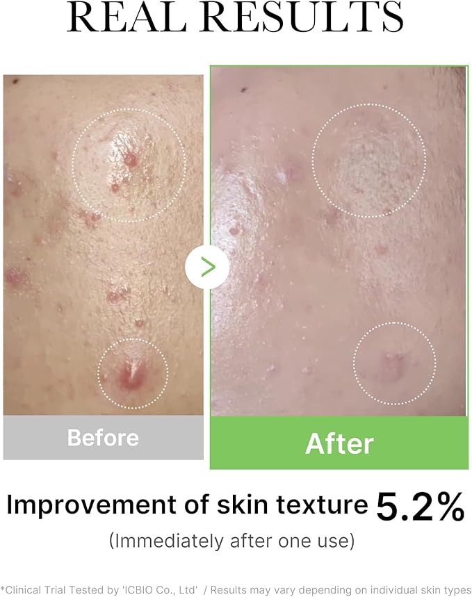 Exosome Cica Ampoule - 30 ml-Medicube-Noura Skincare