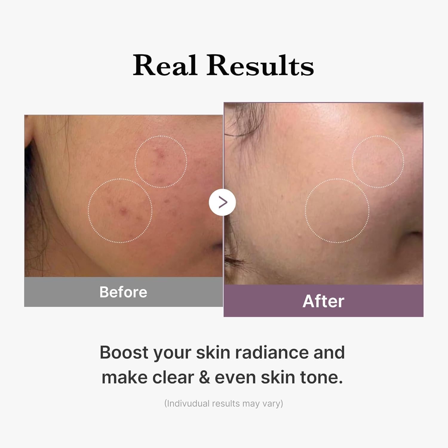 AGE-R Glutathione Glow Toner - 140 ml-Medicube-Noura Skincare