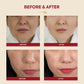 SEOUL 1988 Essence: Snail Mucin 97% + Rice-K-SECRET-Noura Skincare