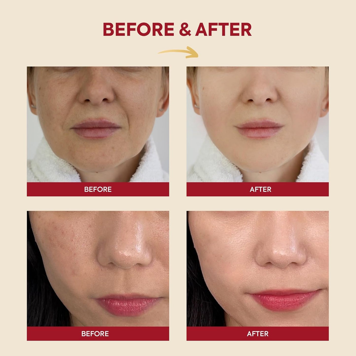 SEOUL 1988 Essence: Snail Mucin 97% + Rice-K-SECRET-Noura Skincare