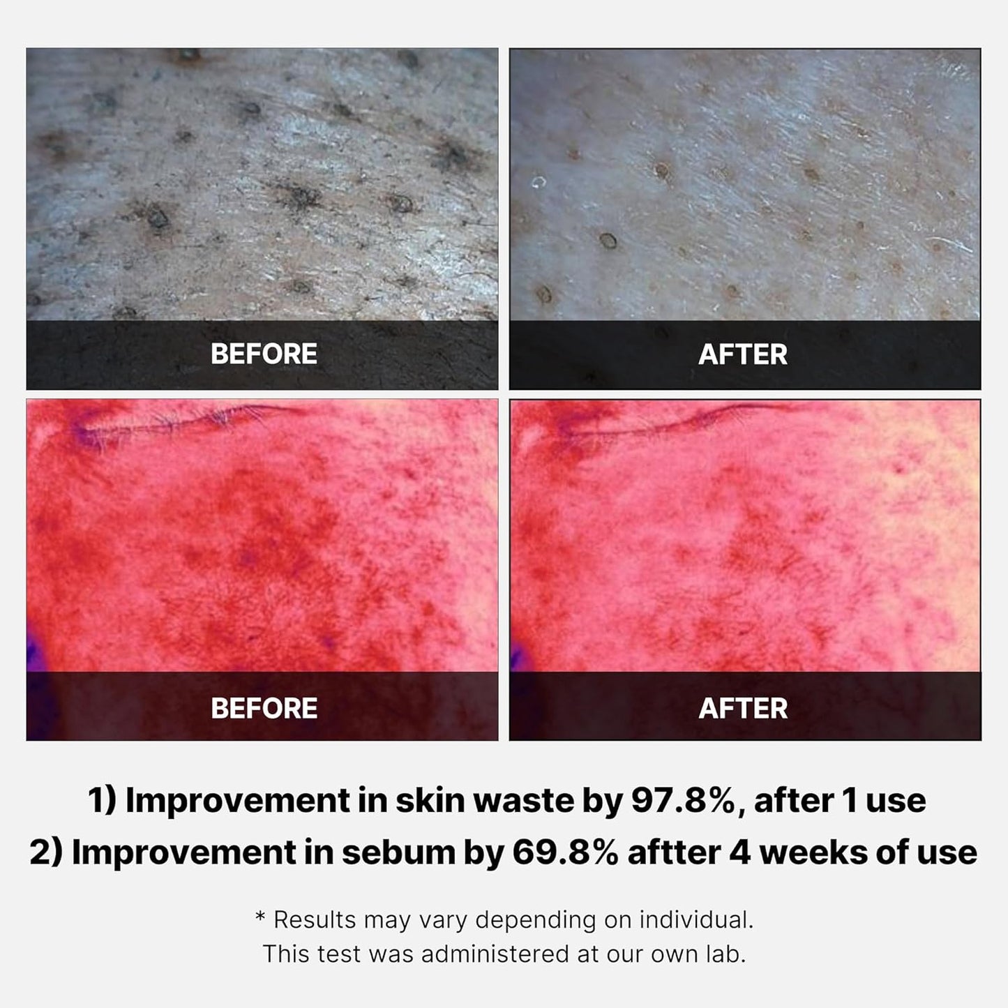 Red Succinic Acid Peeling Pad - 155g-Medicube-Noura Skincare