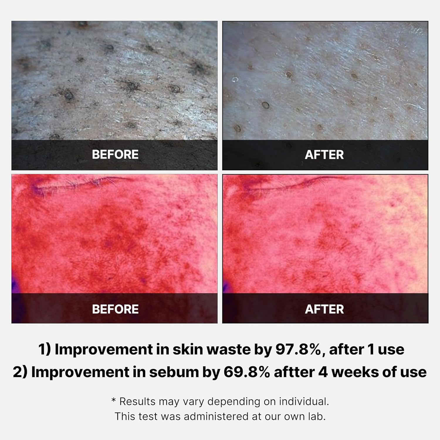 Red Succinic Acid Peeling Pad - 155g-Medicube-Noura Skincare