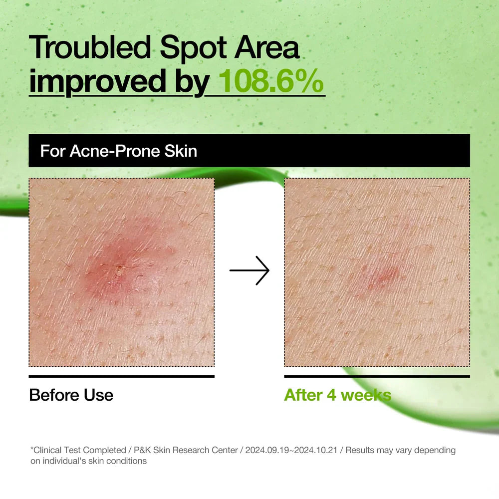 Azelaic Acid 10 Hyaluron Redness Soothing Serum - 30ml-ANUA-Noura Skincare