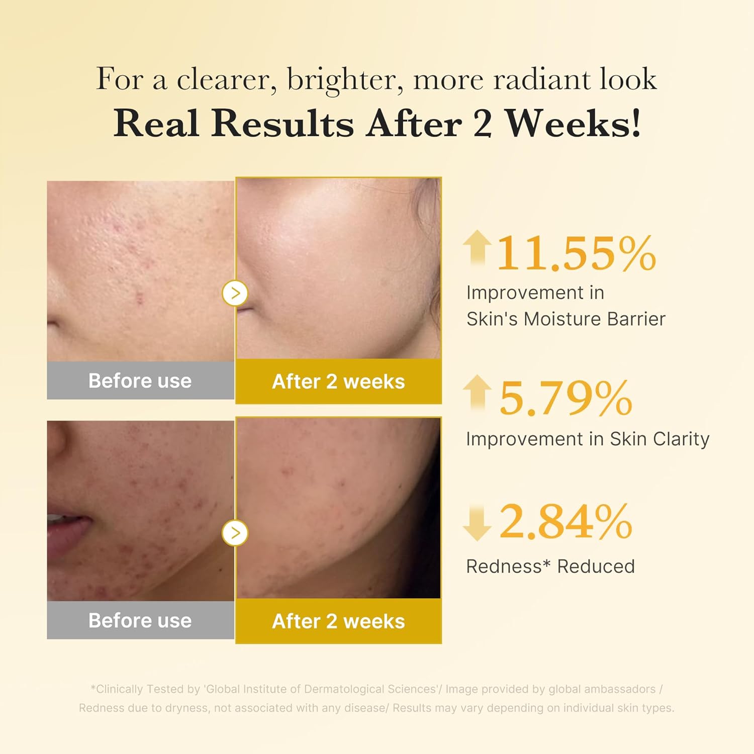 Before and after skin improvement results with percentages on a beige background