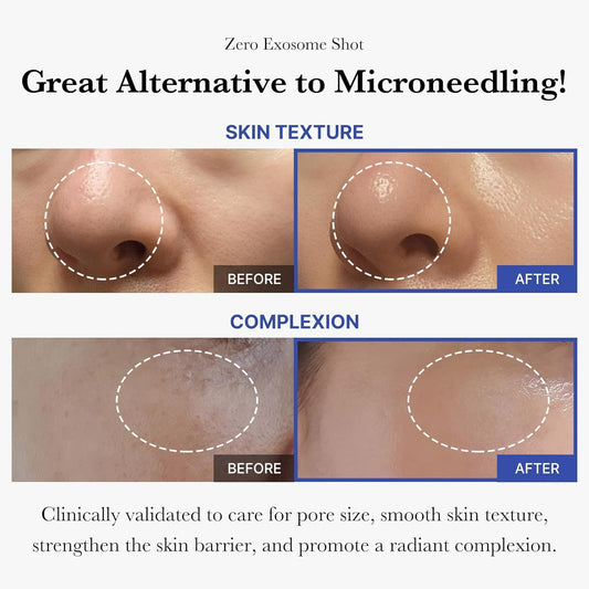 Before and after comparison of skin texture and complexion with text highlighting benefits by nouraskincare.