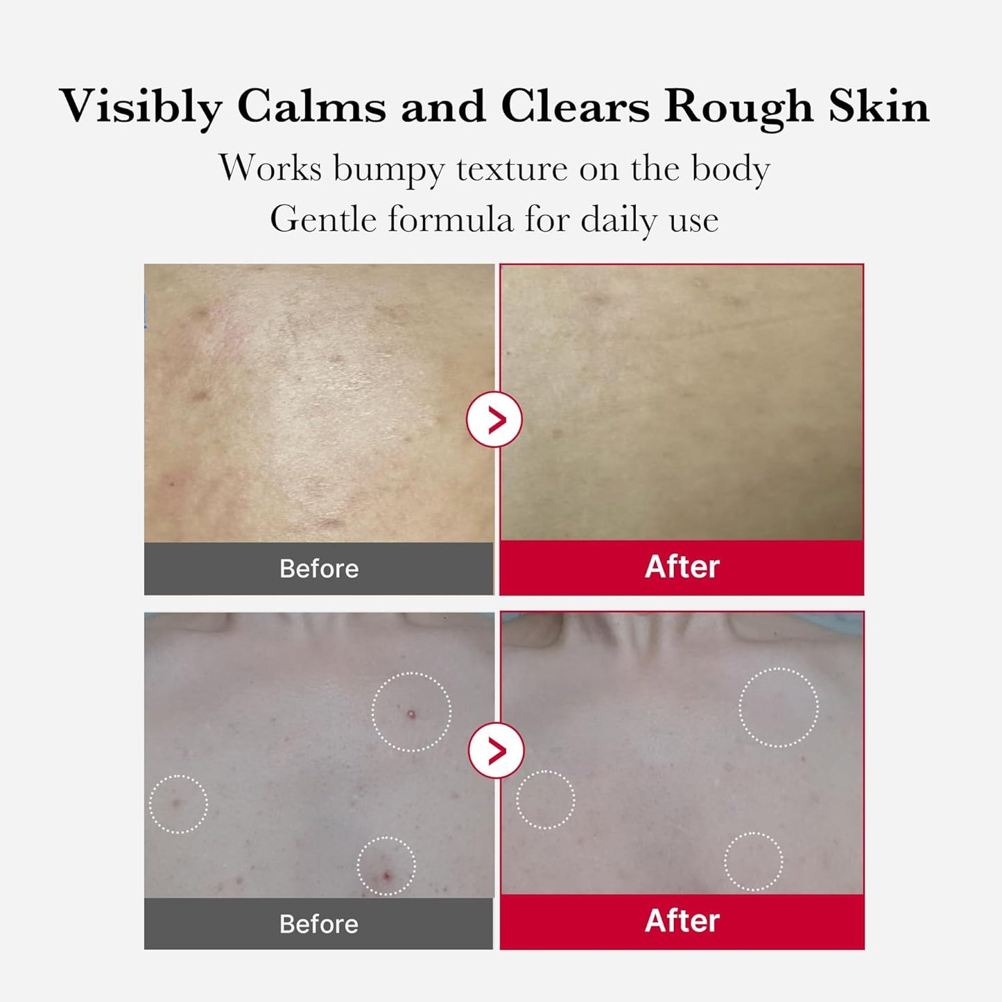 Before and after comparison of skin texture with text indicating product benefits.