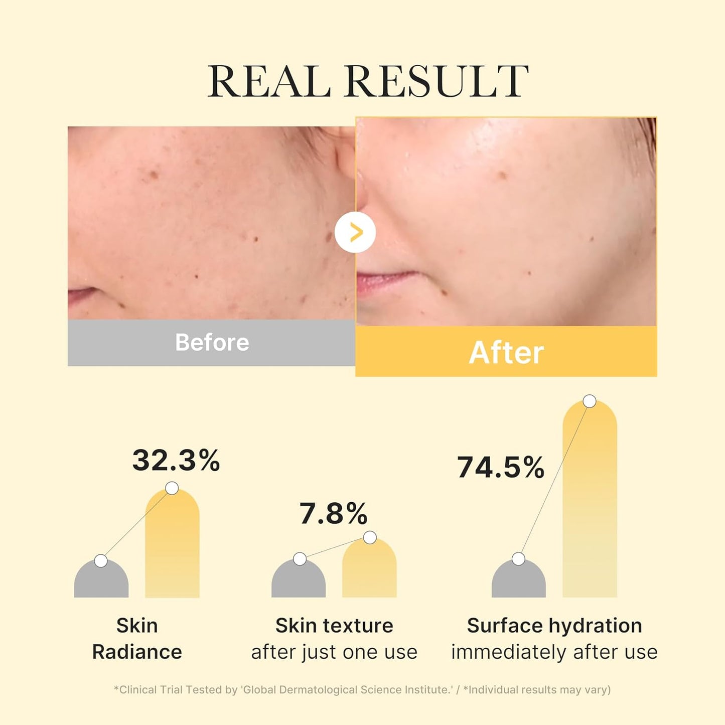 Kojic Acid Turmeric Gel Mask - 4ea