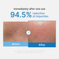 Before and after comparison of skin impurities reduction with text indicating 94.5% reduction after one use.
