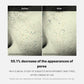 Before and after comparison of skin texture with text indicating pore reduction.