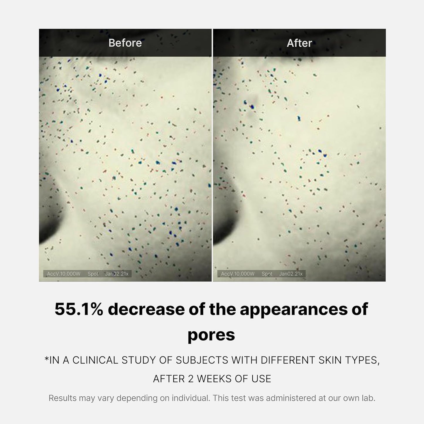 Before and after comparison of skin texture with text indicating pore reduction.