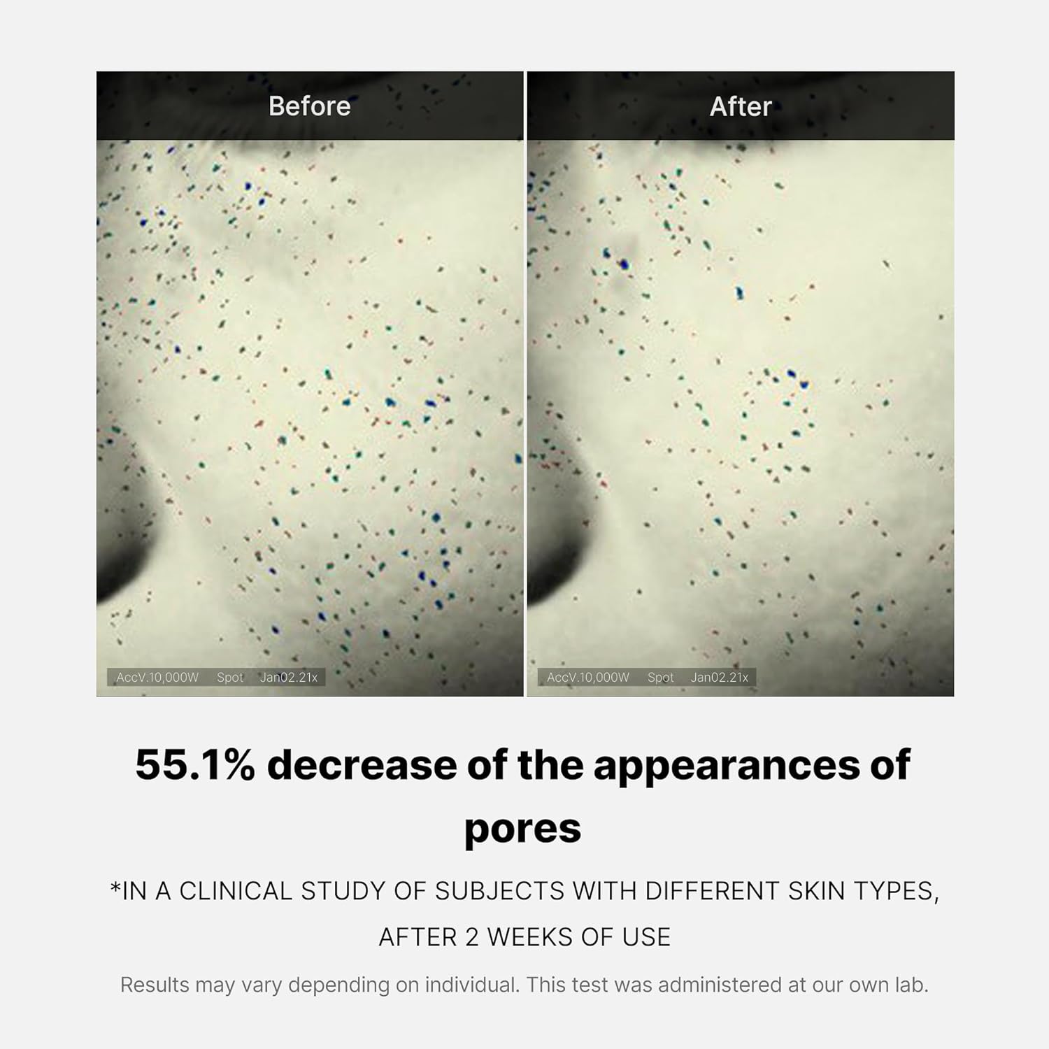 Before and after comparison of skin texture with text indicating pore reduction.