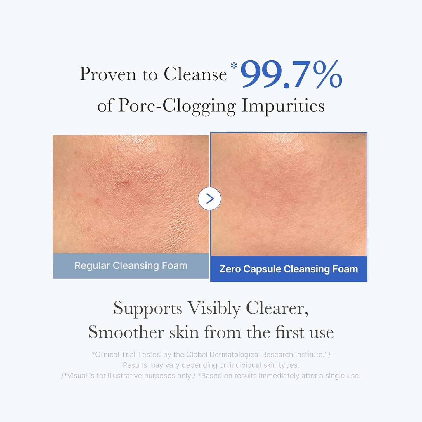 Zero Pore SA Clear Capsule Cleansing Foam - 120g