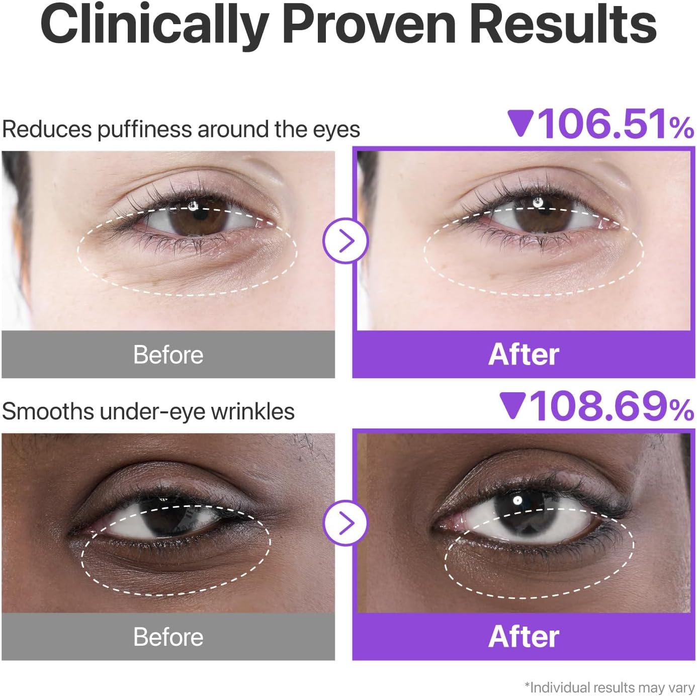 NAD+ Collagen Under Eye Patches