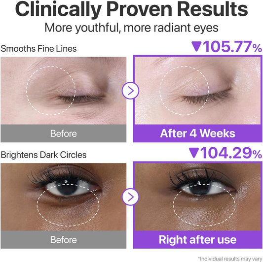 No.9 NAD+ Retinol Volumetox Eye Cream