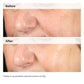 Alpha Arbutin 2% + HA-The Ordinary-Noura Skincare