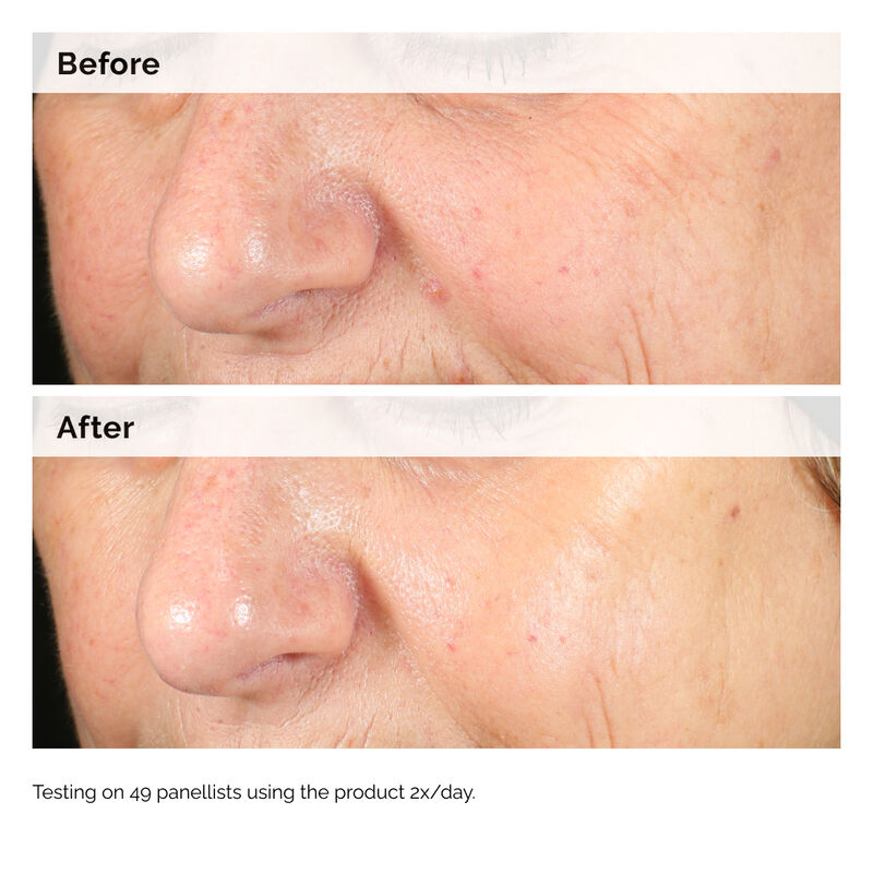 Alpha Arbutin 2% + HA-The Ordinary-Noura Skincare