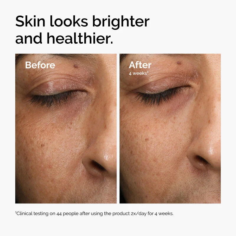 Multi-Antioxidant Radiance Serum - 30ml-The Ordinary-Noura Skincare