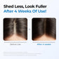 Scalpy Hair Serum - 20ml